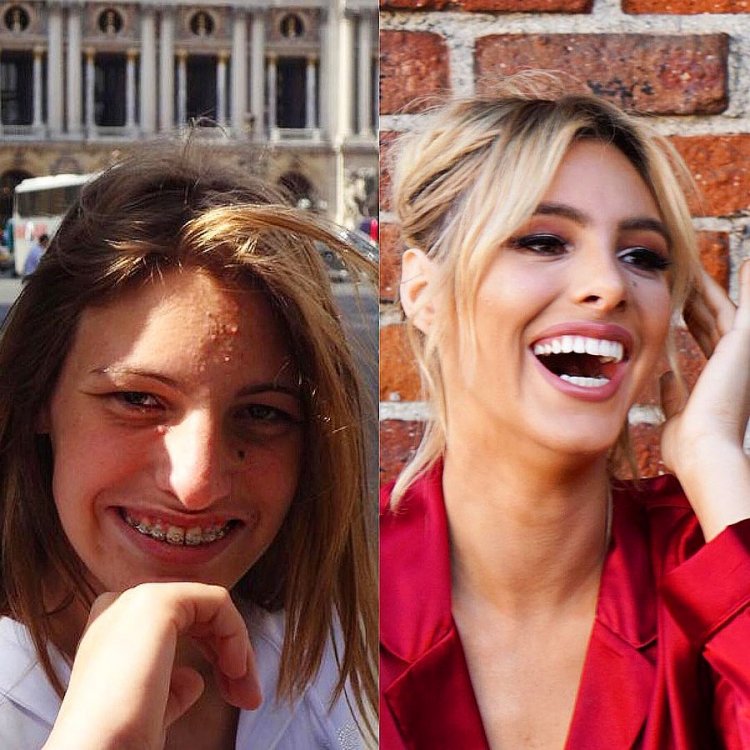 Lele Pons kimdir? Juanpa Zurita ile ayrıldı mı? Kiminle sevgili?