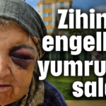 Zihinsel engelliye yumruklu saldırı