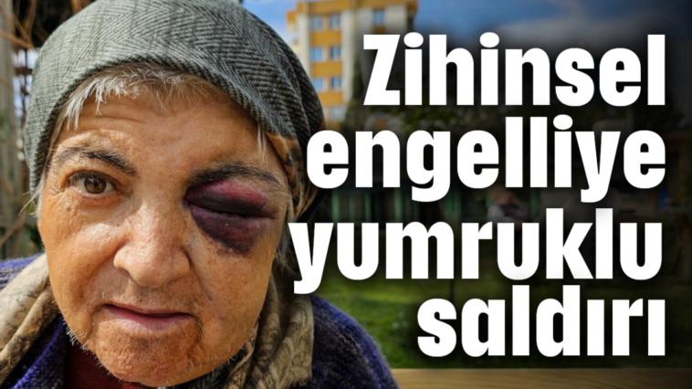 Zihinsel engelliye yumruklu saldırı