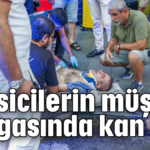 Taksicilerin müşteri kavgasında kan aktı