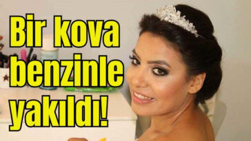 Bir kova benzinle yakıldı! 20 gün dayanabildi